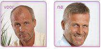 contacskin